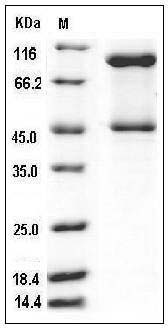 Mouse Serpinb3c Protein (His Tag) SDS-PAGE