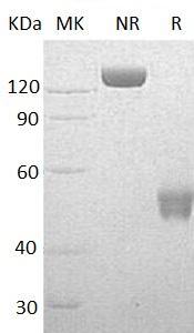 Human NCR3/1C7/LY117 (Fc tag) recombinant protein