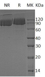 Human PDGFRB/PDGFR/PDGFR1 (His tag) recombinant protein