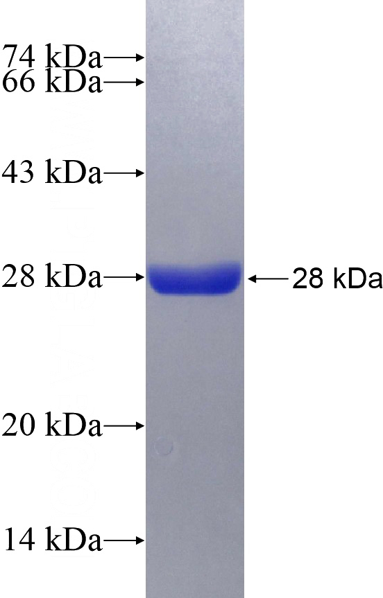 Recombinant Human TRIM59 SDS-PAGE