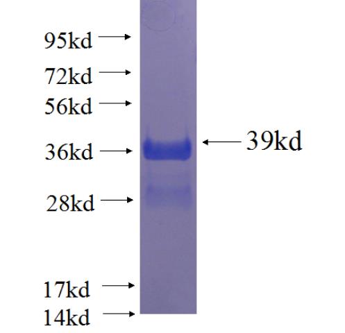 Recombinant human DNAJC19 SDS-PAGE