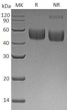 Human SIRPB1 (His tag) recombinant protein