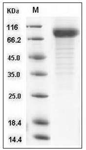 Human IL22BP / IL22RA2 Protein (His & Fc Tag) SDS-PAGE