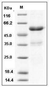 Human Ephrin-A1 / EFNA1 Protein (His & Fc Tag) SDS-PAGE
