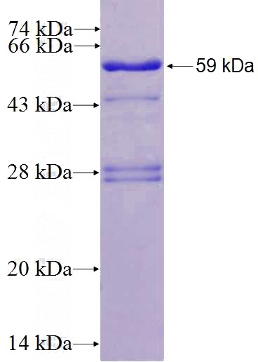 Recombinant Human CCND2 SDS-PAGE