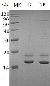 Human ERMAP/RD/SC (His tag) recombinant protein