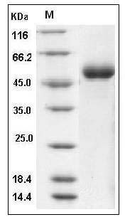 Mouse DDR1 Kinase / MCK10 / CD167 Protein (His Tag) SDS-PAGE