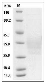 Mouse CD79B / B29 Protein (His Tag) SDS-PAGE