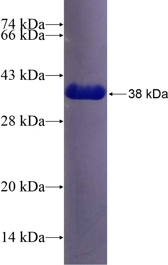 Recombinant Human RPLP2 SDS-PAGE