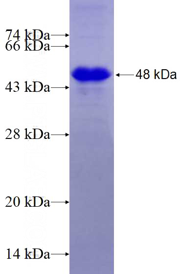 Recombinant Human LUZP4 SDS-PAGE