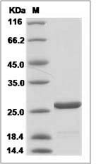GAG-P24 protein SDS-PAGE