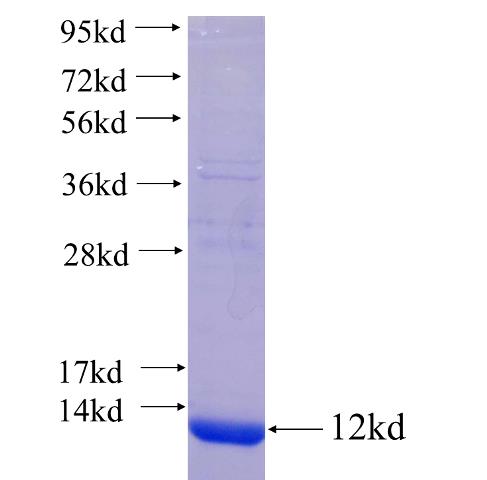 Recombinant human PXMP2 SDS-PAGE