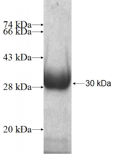 Recombinant Human ATP4B SDS-PAGE
