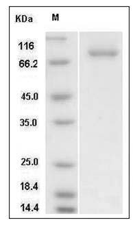 Human SRC Kinase / Proto-oncogene c-Src Protein (His & GST Tag) SDS-PAGE