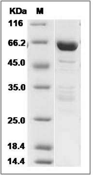 Human DCAMKL1 / DCLK1 Protein SDS-PAGE