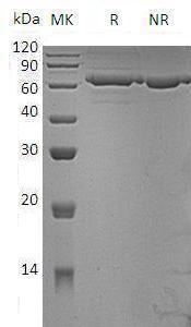 Mouse Pm20d1 (His tag) recombinant protein