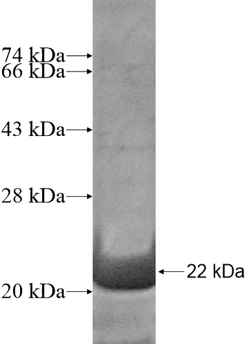 Recombinant Human AMELY SDS-PAGE