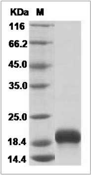 Human CCL28 Protein (His Tag) SDS-PAGE