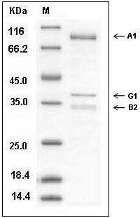 Human AMPK (G1/B2/A1) Heterotrimer Protein SDS-PAGE
