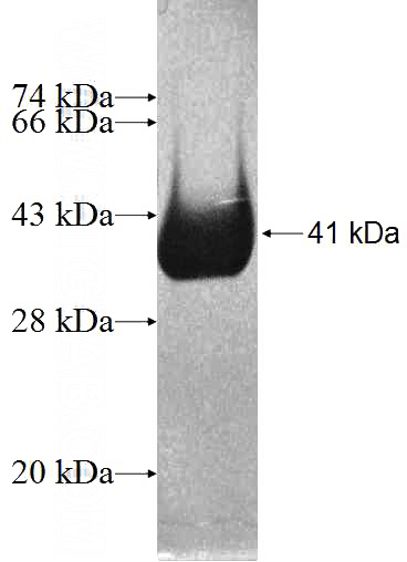 Recombinant Human LRP3 SDS-PAGE