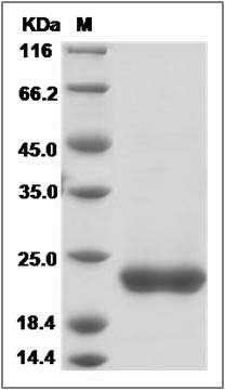 Rat COPZ1 Protein (His Tag)