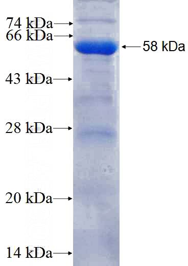 Recombinant Human INPP5F SDS-PAGE