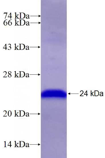 Recombinant Human ALKBH1 SDS-PAGE