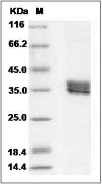 Human TPM4 / Tropomyosin 4 Protein (His Tag) SDS-PAGE