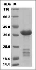 Mouse IGFBP-2 / IGFBP2 Protein (His Tag)