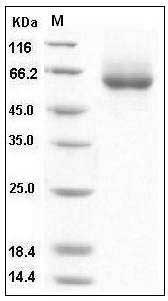 Human ENPP7 / NPP-7 Protein (His Tag) SDS-PAGE