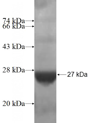 Recombinant Human RPL18A SDS-PAGE