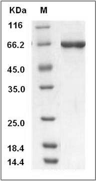 Human STK40 Protein (His & GST Tag) SDS-PAGE