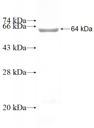 Recombinant Human ADCY6 SDS-PAGE