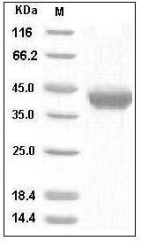 Human AgRP Protein (Fc Tag) SDS-PAGE