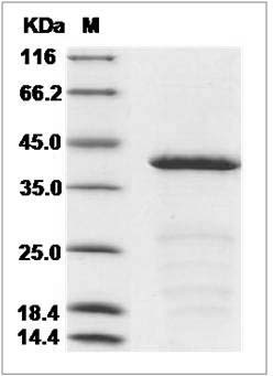 Human NPM1 / Nucleophosmin (aa 2-294) Protein (His Tag)