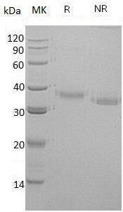Human CRHBP/CRFBP (His tag) recombinant protein