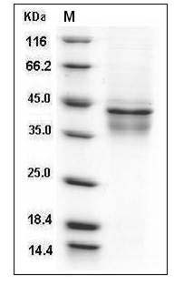 Human IL-12 (IL12A & IL12B Heterodimer) Protein SDS-PAGE