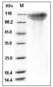 Human OMGP / OMG Protein (aa 1-420, His Tag) SDS-PAGE
