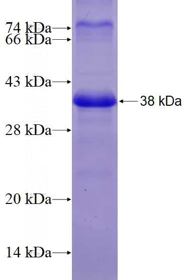 Recombinant Human DTX2 SDS-PAGE