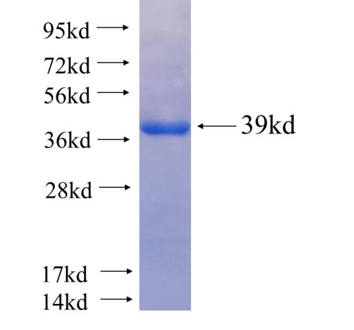 Recombinant human TRIM2 SDS-PAGE