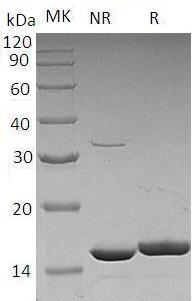 Human CSF3/C17orf33/GCSF recombinant protein