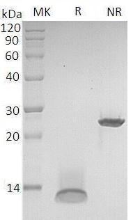 Mouse Tgfb1 recombinant protein