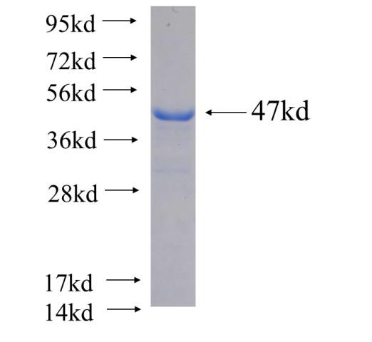 Recombinant Arabidopsis thaliana MPK6 SDS-PAGE