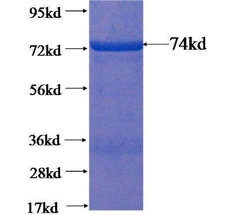Recombinant human TBCEL SDS-PAGE