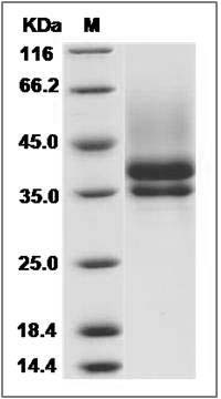 Rat IL7R / IL7RA Protein (His Tag) SDS-PAGE