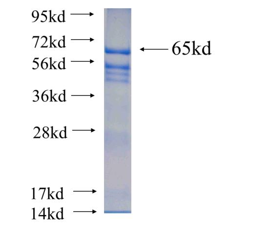Recombinant human SCIN SDS-PAGE