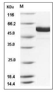 Human FUT8 Protein (aa 68-575, His Tag) SDS-PAGE