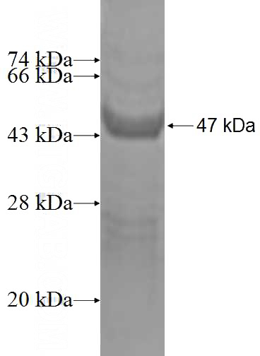 Recombinant Human DCTN3 SDS-PAGE