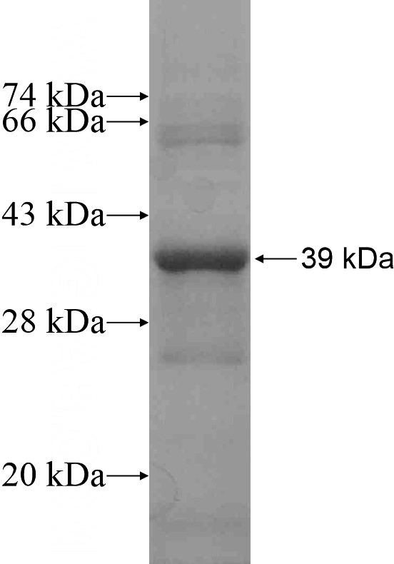 Recombinant Human ADCY9 SDS-PAGE