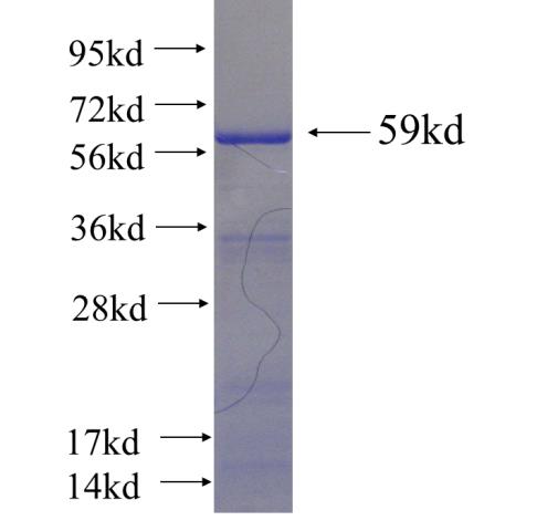 Recombinant Arabidopsis thaliana CBL SDS-PAGE